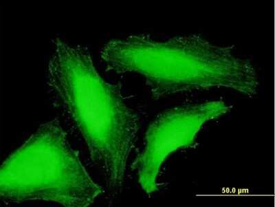 Immunocytochemistry/ Immunofluorescence: TAF8 Antibody [H00129685-B01P]