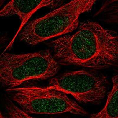 Immunocytochemistry/ Immunofluorescence: TAF8 Antibody [NBP2-38188]