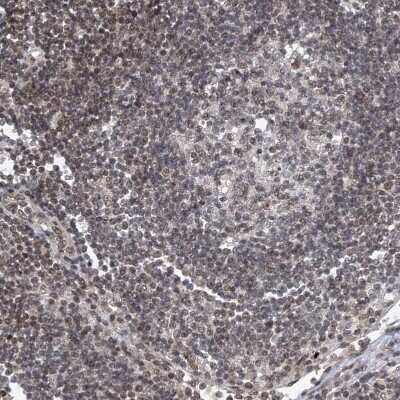 Immunohistochemistry-Paraffin: TAF8 Antibody [NBP2-38188]