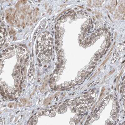 Immunohistochemistry-Paraffin: TAF8 Antibody [NBP2-38188]