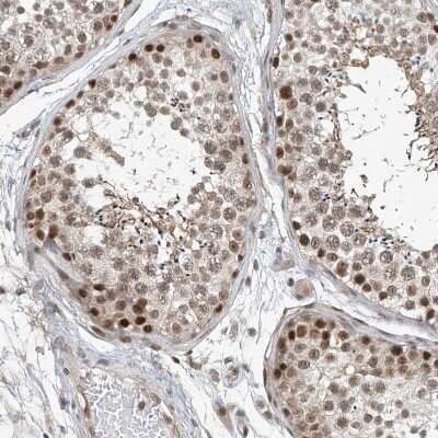 Immunohistochemistry-Paraffin: TAF8 Antibody [NBP2-38188]