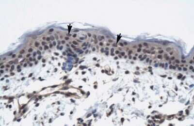 Immunohistochemistry: TAF9 Antibody [NBP2-84289]
