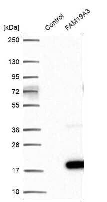 Western Blot: TAFA3/FAM19A3 Antibody [NBP2-30489]