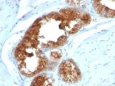 Immunohistochemistry-Paraffin: TAG-72 Antibody (B72.3 + CA72/733) - Azide and BSA Free [NBP2-34557]