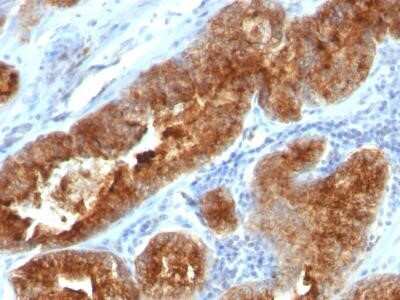 Immunohistochemistry-Paraffin: TAG-72 Antibody (B72.3 + CC49) - IHC-Prediluted [NBP2-45179]