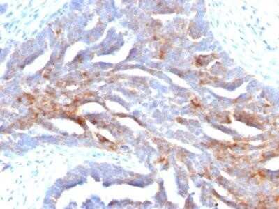 Immunohistochemistry-Paraffin: TAG-72 Antibody (B72.3) - IHC-Prediluted [NBP2-45173]