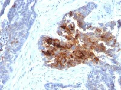 Immunohistochemistry-Paraffin: TAG-72 Antibody (CA72/2869R) - Azide and BSA Free [NBP3-08661]