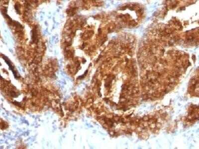 Immunohistochemistry-Paraffin: TAG-72 Antibody (CA72/733) - Azide and BSA Free [NBP2-34591]