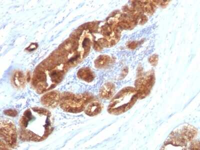 Immunohistochemistry-Paraffin: TAG-72 Antibody (CC49) - Azide and BSA Free [NBP2-33128]