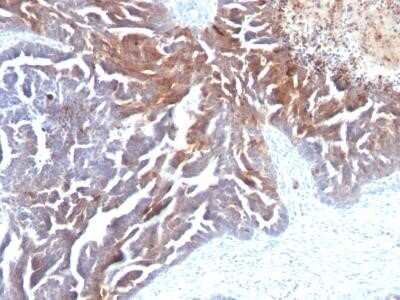 Immunohistochemistry-Paraffin: TAG-72 Antibody (CC49) - IHC-Prediluted [NBP2-45175]