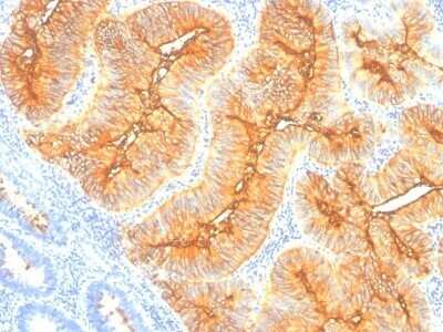 Immunohistochemistry-Paraffin: TAG-72 Antibody (SPM148) - IHC-Prediluted [NBP2-45174]