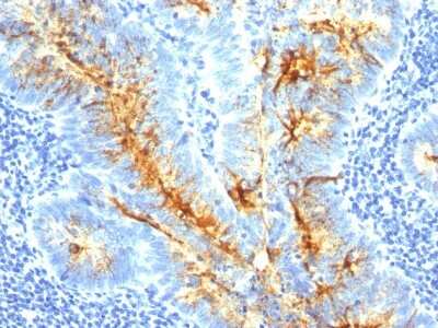 Immunohistochemistry-Paraffin: TAG-72 Antibody (SPM536) - Azide and BSA Free [NBP2-34783]