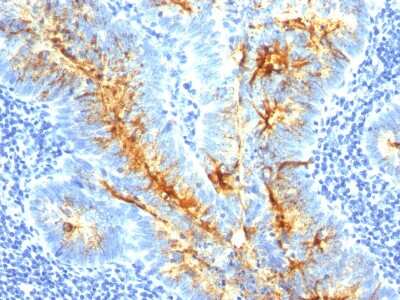 Immunohistochemistry-Paraffin: TAG-72 Antibody (SPM536) [NBP2-32996]