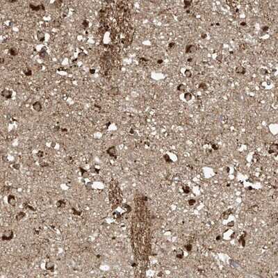 Immunohistochemistry-Paraffin: TAGAP Antibody [NBP1-88826]