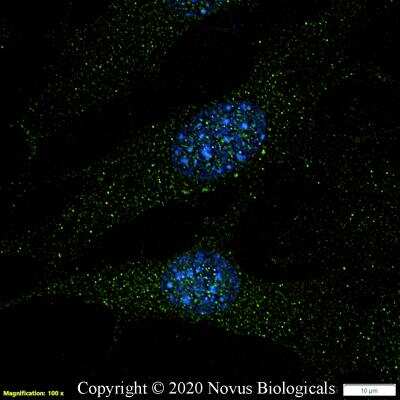 Immunocytochemistry/ Immunofluorescence: TAK1 Antibody [NB100-56363]