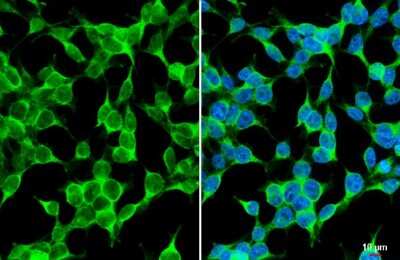 Immunocytochemistry/ Immunofluorescence: TAK1 Antibody [NBP3-13401]