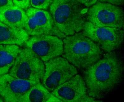 Immunocytochemistry/ Immunofluorescence: TAK1 Antibody (JM73-19) [NBP2-67180]