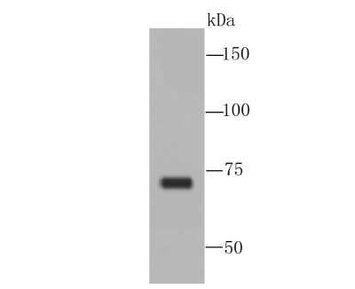 Western Blot: TAK1 Antibody (JM73-19) [NBP2-67180]