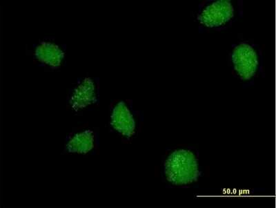 Immunocytochemistry/ Immunofluorescence: TAK1L Antibody [H00056911-B01P]