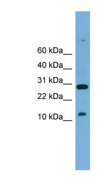 Western Blot: TAL2 Antibody [NBP1-80224]