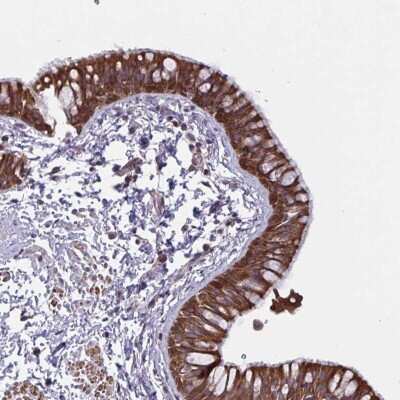 Immunohistochemistry: TANK Antibody [NBP2-38358]