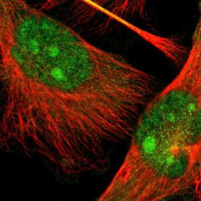 Immunocytochemistry/ Immunofluorescence: TAO2 Antibody [NBP1-81465]