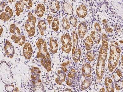 Immunohistochemistry-Paraffin: TAPT1 Antibody [NBP2-98498]