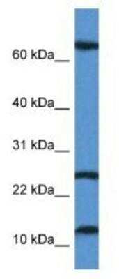 Western Blot: TARP Antibody [NBP1-74080]
