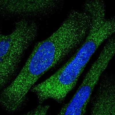Immunocytochemistry/ Immunofluorescence: TARS Antibody [NBP1-89427]
