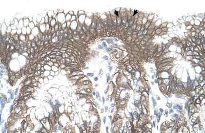 Immunohistochemistry-Paraffin: TARS Antibody [NBP1-55369]