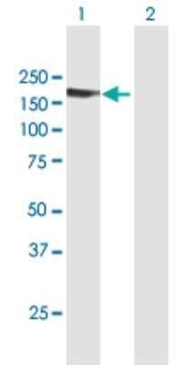 Western Blot: TARSH Antibody [H00025890-B01P]