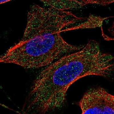 Immunocytochemistry/ Immunofluorescence: TARSL2 Antibody [NBP2-56375]