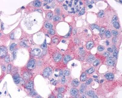 Immunohistochemistry-Paraffin: TAS1R2 Antibody - BSA Free [NLS2007]