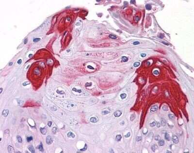 Immunohistochemistry-Paraffin: TAS1R3 Antibody - BSA Free [NLS5060]