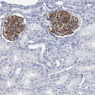Immunohistochemistry-Paraffin: TAS2R1 Antibody [NBP2-33632]