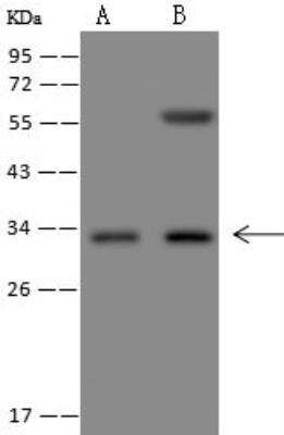 Western Blot: TAS2R1 Antibody [NBP3-12625]