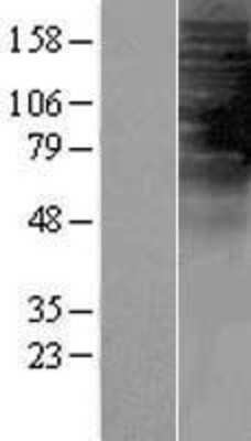 Western Blot: TAS2R1 Overexpression Lysate [NBP2-06713]