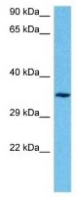 Western Blot: TAS2R14 Antibody [NBP3-10050]