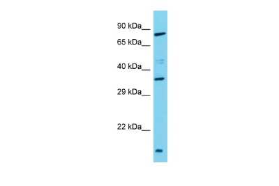 Western Blot: TAS2R3 Antibody [NBP3-09626]
