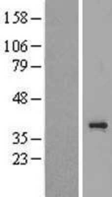 Western Blot: TAS2R3 Overexpression Lysate [NBP2-06986]