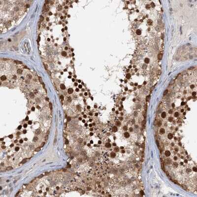 Immunohistochemistry-Paraffin: TAS2R42 Antibody [NBP1-83154]
