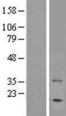 Western Blot: TAS2R7 Overexpression Lysate [NBL1-16712]