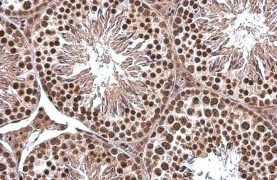 Immunohistochemistry-Paraffin: TATA binding protein TBP Antibody [NBP3-13174]