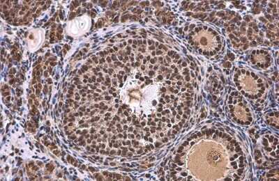 Immunohistochemistry-Paraffin: TATA binding protein TBP Antibody [NBP3-13174]