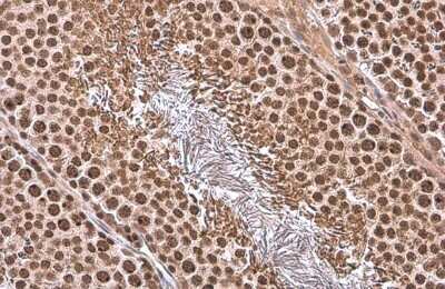 Immunohistochemistry-Paraffin: TATA binding protein TBP Antibody [NBP3-13174]