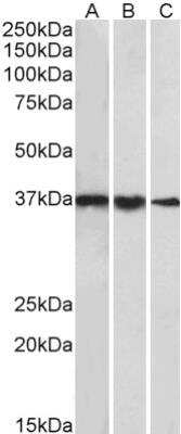 Western Blot: TATA binding protein TBP Antibody [NBP2-12933]