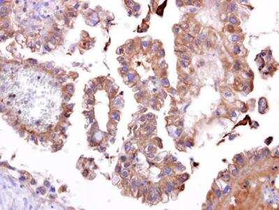 Immunohistochemistry: TATDN1 Antibody [NBP1-31569]