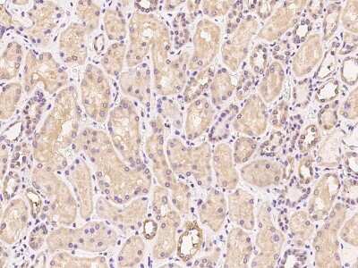 Immunohistochemistry-Paraffin: TATDN1 Antibody [NBP2-97967]