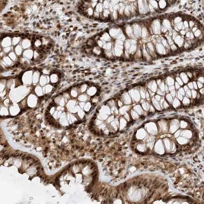 Immunohistochemistry-Paraffin: TATDN3 Antibody [NBP1-91010]