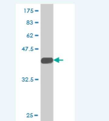 Western Blot: TAX1BP3 Antibody (1H5) [H00030851-M02]
